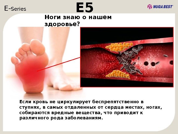 E- Series  E 5 Ноги знаю о нашем здоровье? Если кровь не циркулирует